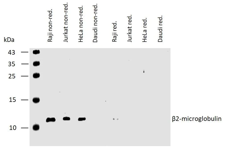 Western blot - Anti-beta 2 Microglobulin antibody [B2M-01] (AB759)