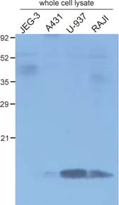 Western blot - Anti-beta 2 Microglobulin antibody [B2M-01] (AB759)