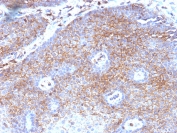 Immunohistochemistry (Formalin/PFA-fixed paraffin-embedded sections) - Anti-beta 2 Microglobulin antibody [B2M/1118] (AB215882), expandable thumbnail