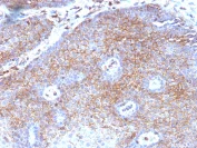 Immunohistochemistry (Formalin/PFA-fixed paraffin-embedded sections) - Anti-beta 2 Microglobulin antibody [B2M/1118] (AB215882)