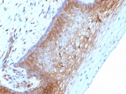 Immunohistochemistry (Formalin/PFA-fixed paraffin-embedded sections) - Anti-beta 2 Microglobulin antibody [B2M/1118] (AB215882), expandable thumbnail