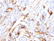 Immunohistochemistry (Formalin/PFA-fixed paraffin-embedded sections) - Anti-beta 2 Microglobulin antibody [B2M/1118] (AB215882), expandable thumbnail