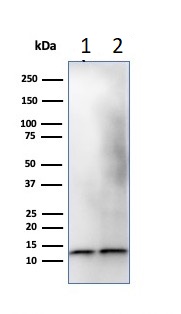 Western blot - Anti-beta 2 Microglobulin antibody [B2M/1118] (AB215882), expandable thumbnail