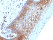 Immunohistochemistry (Formalin/PFA-fixed paraffin-embedded sections) - Anti-beta 2 Microglobulin antibody [B2M/1118] - BSA and Azide free (AB212752)