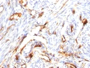 Immunohistochemistry (Formalin/PFA-fixed paraffin-embedded sections) - Anti-beta 2 Microglobulin antibody [B2M/1118] - BSA and Azide free (AB212752)