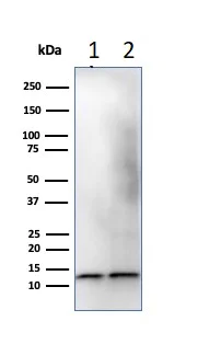Western blot - Anti-beta 2 Microglobulin antibody [B2M/1118] - BSA and Azide free (AB212752)