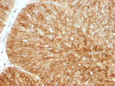 Immunohistochemistry (Formalin/PFA-fixed paraffin-embedded sections) - Anti-beta 2 Microglobulin antibody [B2M/1857R] - BSA and Azide free (AB236429)