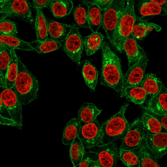 Immunocytochemistry - Anti-beta 2 Microglobulin antibody [B2M/961] (AB215889), expandable thumbnail