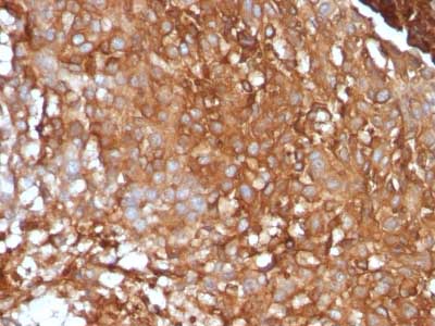 Immunohistochemistry (Formalin/PFA-fixed paraffin-embedded sections) - Anti-beta 2 Microglobulin antibody [B2M/961] (AB215889), expandable thumbnail