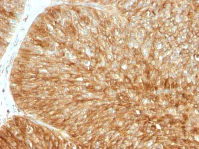 Immunohistochemistry (Formalin/PFA-fixed paraffin-embedded sections) - Anti-beta 2 Microglobulin antibody [B2M/961] (AB215889)