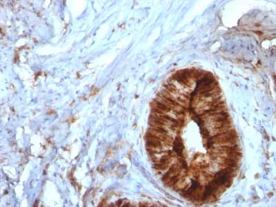 Immunohistochemistry (Formalin/PFA-fixed paraffin-embedded sections) - Anti-beta 2 Microglobulin antibody [B2M/961] (AB215889), expandable thumbnail