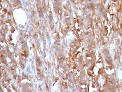 Immunohistochemistry (Formalin/PFA-fixed paraffin-embedded sections) - Anti-beta 2 Microglobulin antibody [B2M/961] (ab215889), expandable thumbnail