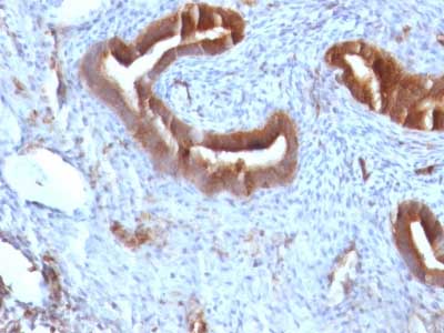 Immunohistochemistry (Formalin/PFA-fixed paraffin-embedded sections) - Anti-beta 2 Microglobulin antibody [B2M/961] (ab215889), expandable thumbnail