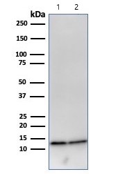 Western blot - Anti-beta 2 Microglobulin antibody [B2M/961] (AB215889), expandable thumbnail