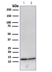 Western blot - Anti-beta 2 Microglobulin antibody [B2M/961] (AB215889)