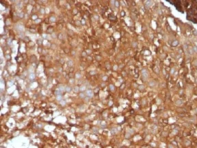 Immunohistochemistry (Formalin/PFA-fixed paraffin-embedded sections) - Anti-beta 2 Microglobulin antibody [B2M/961] - BSA and Azide free (AB212756)