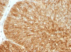Immunohistochemistry (Formalin/PFA-fixed paraffin-embedded sections) - Anti-beta 2 Microglobulin antibody [B2M/961] - BSA and Azide free (AB212756)