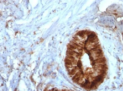 Immunohistochemistry (Formalin/PFA-fixed paraffin-embedded sections) - Anti-beta 2 Microglobulin antibody [B2M/961] - BSA and Azide free (AB212756)