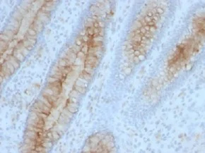Immunohistochemistry (Formalin/PFA-fixed paraffin-embedded sections) - Anti-beta 2 Microglobulin antibody [B2M/961] - BSA and Azide free (AB212756)