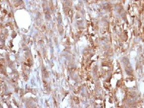 Immunohistochemistry (Formalin/PFA-fixed paraffin-embedded sections) - Anti-beta 2 Microglobulin antibody [B2M/961] - BSA and Azide free (AB212756)