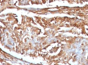 Immunohistochemistry (Formalin/PFA-fixed paraffin-embedded sections) - Anti-beta 2 Microglobulin antibody [B2M/961] - BSA and Azide free (AB212756)