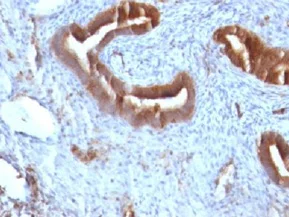 Immunohistochemistry (Formalin/PFA-fixed paraffin-embedded sections) - Anti-beta 2 Microglobulin antibody [B2M/961] - BSA and Azide free (AB212756)