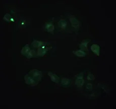 Immunocytochemistry/ Immunofluorescence - Anti-beta 2 Microglobulin antibody [D2E9] (AB198486)