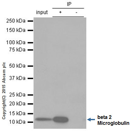 Immunoprecipitation - Anti-beta 2 Microglobulin antibody [EP2978Y] (AB75853), expandable thumbnail