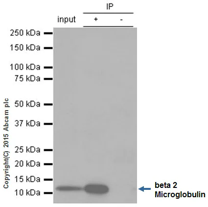 Immunoprecipitation - Anti-beta 2 Microglobulin antibody [EP2978Y] (AB75853)