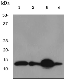 Western blot - Anti-beta 2 Microglobulin antibody [EP2978Y] (AB75853)
