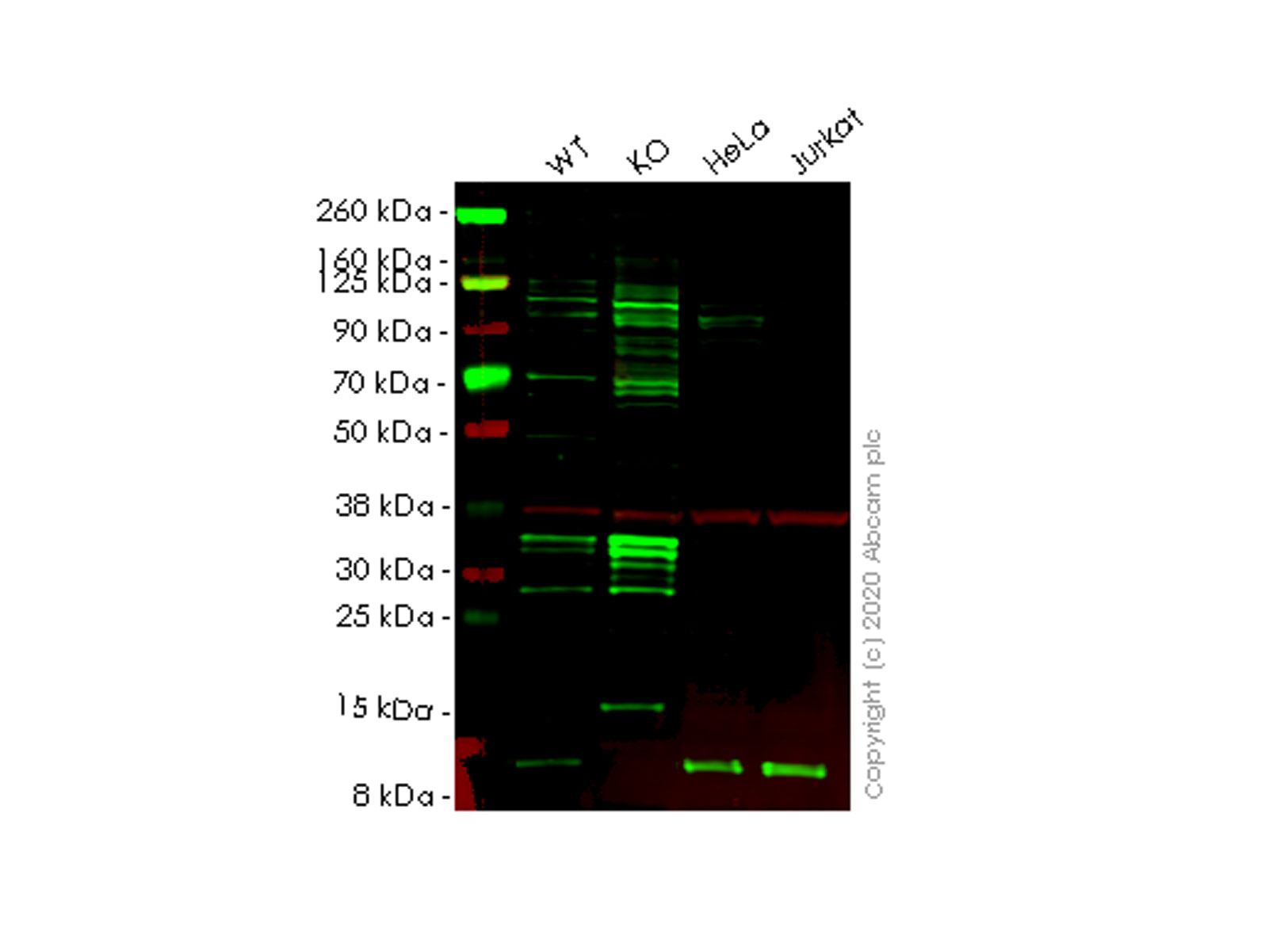 Western blot - Anti-beta 2 Microglobulin antibody [EP2978Y] (AB75853), expandable thumbnail