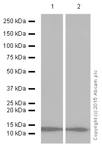 Western blot - Anti-beta 2 Microglobulin antibody [EP2978Y] (AB75853), expandable thumbnail
