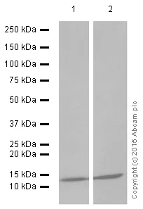 Western blot - Anti-beta 2 Microglobulin antibody [EP2978Y] (AB75853)