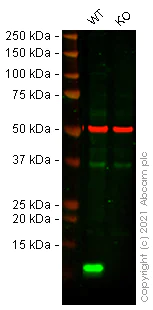 Western blot - Anti-beta 2 Microglobulin antibody [EPR21752-214] (AB218230)
