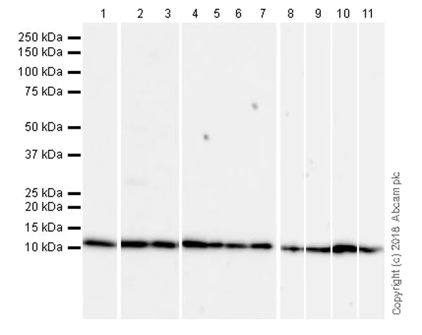 Western blot - Anti-beta 2 Microglobulin antibody [EPR21752-214] (AB218230)