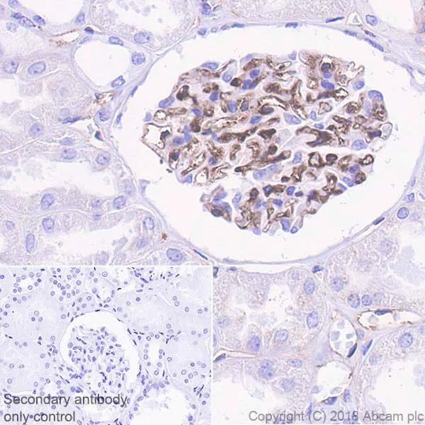Immunohistochemistry (Formalin/PFA-fixed paraffin-embedded sections) - Anti-beta 2 Microglobulin antibody [EPR21752-214] - BSA and Azide free (AB237032)