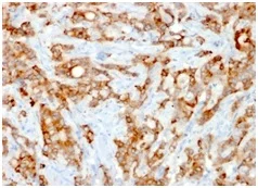 Immunohistochemistry (Formalin/PFA-fixed paraffin-embedded sections) - Anti-beta 2 Microglobulin antibody [rB2M/961] (AB234404)