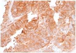 Immunohistochemistry (Formalin/PFA-fixed paraffin-embedded sections) - Anti-beta 2 Microglobulin antibody [rB2M/961] - BSA and Azide free (AB236274), expandable thumbnail