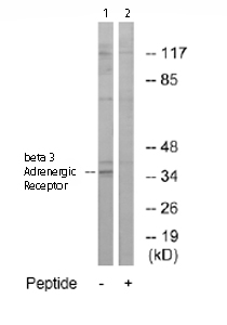 Western blot - Anti-beta 3 Adrenergic Receptor antibody (AB76249), expandable thumbnail