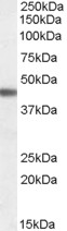 Western blot - Anti-beta 3 Adrenergic Receptor antibody (AB77588)