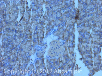 Immunohistochemistry (Formalin/PFA-fixed paraffin-embedded sections) - Anti-beta 3 Adrenergic Receptor antibody (ab94506), expandable thumbnail