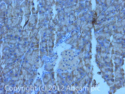 Immunohistochemistry (Formalin/PFA-fixed paraffin-embedded sections) - Anti-beta 3 Adrenergic Receptor antibody (AB94506)