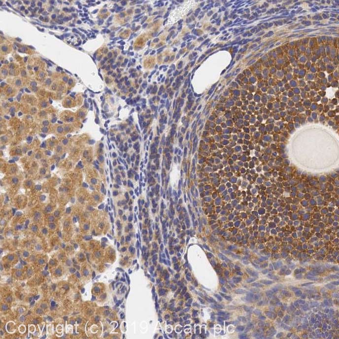 Immunohistochemistry (Formalin/PFA-fixed paraffin-embedded sections) - Anti-beta 3 Adrenergic Receptor antibody (AB94506), expandable thumbnail