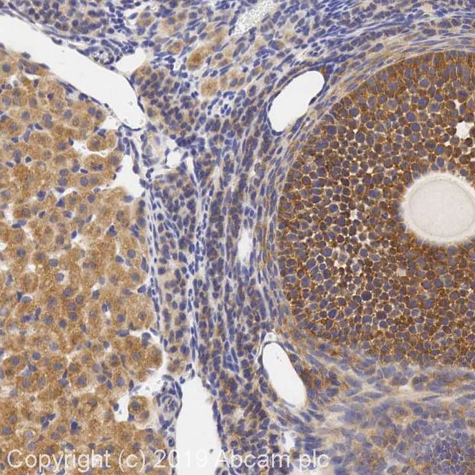 Immunohistochemistry (Formalin/PFA-fixed paraffin-embedded sections) - Anti-beta 3 Adrenergic Receptor antibody (AB94506)