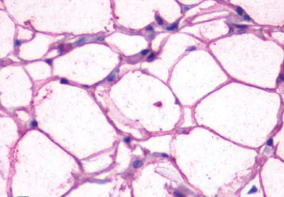 Immunohistochemistry (Formalin/PFA-fixed paraffin-embedded sections) - Anti-beta 3 Adrenergic Receptor antibody - N-terminal (AB140713)