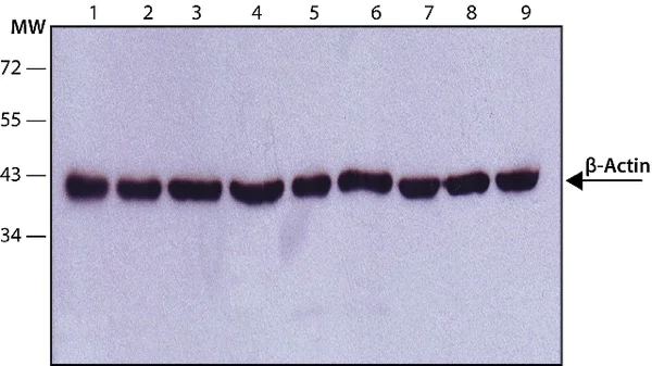 Western blot - Anti-beta Actin antibody [AC-15] - Loading Control (AB6276)