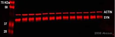 Western blot - Anti-beta Actin antibody [AC-15] - Loading Control (AB6276)
