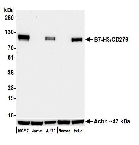 Western blot - Anti-beta Actin antibody [BLR057F] (ab252556), expandable thumbnail