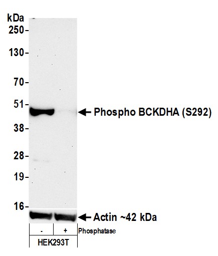 Western blot - Anti-beta Actin antibody [BLR057F] (ab252556), expandable thumbnail
