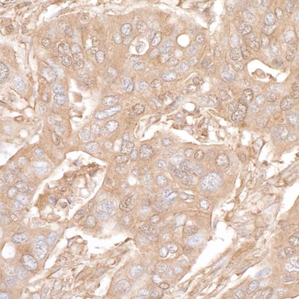 Immunohistochemistry (Formalin/PFA-fixed paraffin-embedded sections) - Anti-beta Actin antibody [BLR057F] - BSA free (AB272085), expandable thumbnail